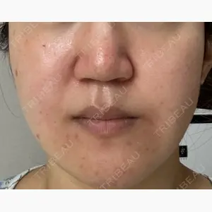 東京美容クリニック 表参道本院口コミ