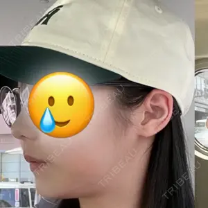 マイン美容外科口コミ