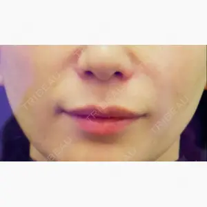 シェリークリニック 新宿本院口コミ