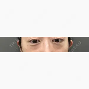 吉井クリニック口コミ