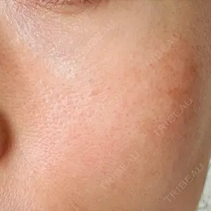 美容皮膚科エルムクリニック 広島院口コミ