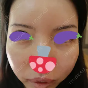 クリム整形外科口コミ