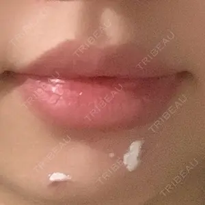 TCB東京中央美容外科 船橋院口コミ