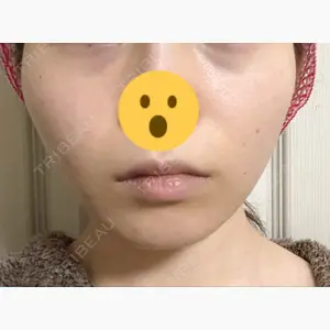 湘南美容クリニック 新橋銀座口院口コミ