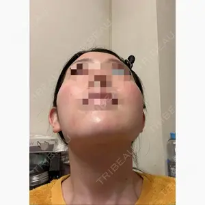 バタン美容整形外科口コミ