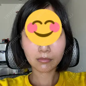 湘南美容クリニック 大阪梅田本院口コミ