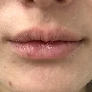 アスク美容クリニック銀座口コミ