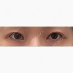 S.T styleクリニック口コミ