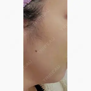 Mavie Beauty Clinic （マヴィービューティークリニック）口コミ