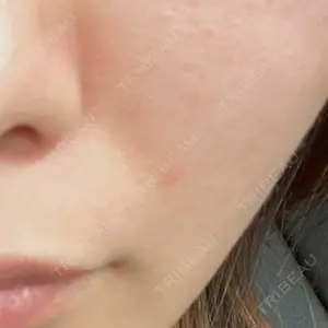 美容皮膚科エルムクリニック 岡山院口コミ