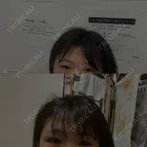 TCB東京中央美容外科 名古屋駅前院口コミ