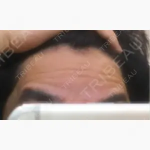 湘南美容クリニック 広島院口コミ