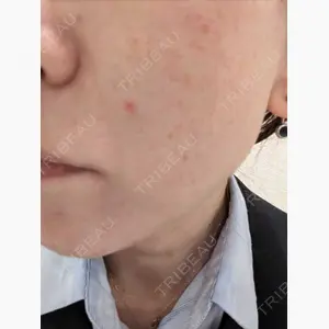 共立美容外科 広島院口コミ