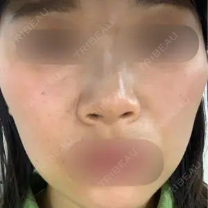 LUNA BEAUTY CLINIC GINZA口コミ