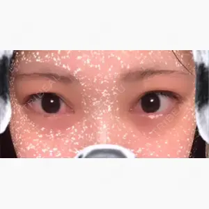 HAAB×DREAM BEAUTY CLINIC 東京本院口コミ
