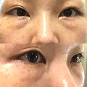 韓国ST美容整形外科口コミ