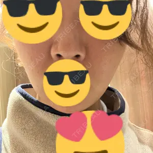 東京形成美容外科 銀座院口コミ