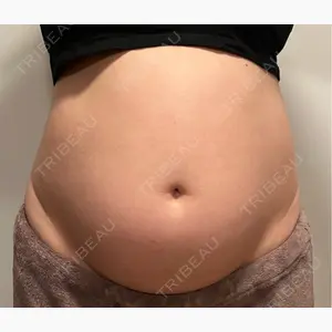 MIO CLINIC 梅田院口コミ