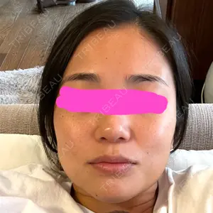 東京美容外科 京都河原町院口コミ