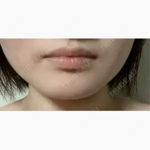 TCB東京中央美容外科 西鉄福岡天神駅前院口コミ