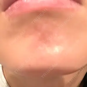 東京美容医療クリニック 池袋院口コミ