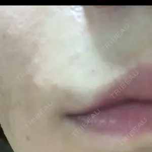 veary clinic口コミ