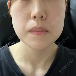 湘南美容クリニック 秋葉原院口コミ