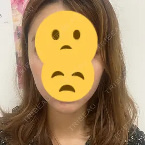 TCB東京中央美容外科 高槻院口コミ