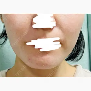 湘南美容クリニック 立川院口コミ