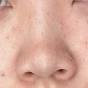R Beauty CLINIC 銀座院口コミ