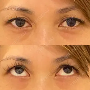 湯田クリニック 銀座口コミ