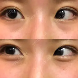 韓国ST美容整形外科口コミ