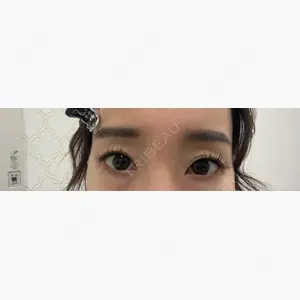 BELINDA CLINIC（ベリンダクリニック）岡山院口コミ