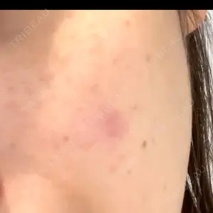 B-LINE CLINIC 大阪院口コミ