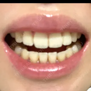 銀座青山You矯正歯科 渋谷院口コミ