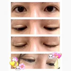 オジスキンクリニック口コミ