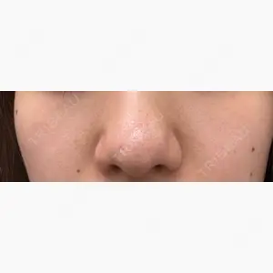 エストクリニック 横浜院口コミ