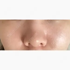 湘南美容クリニック 川崎院口コミ