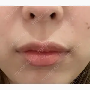 BELINDA CLINIC（ベリンダクリニック）岡山院口コミ