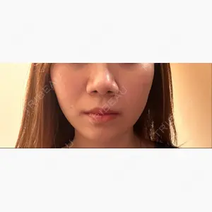 東京形成美容外科 船橋院口コミ