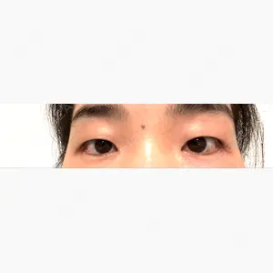 水の森美容クリニック 大阪梅田院口コミ
