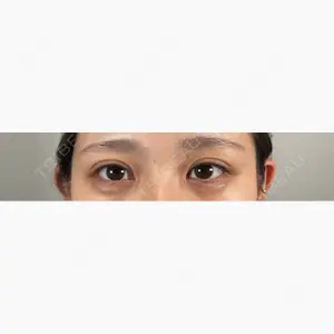 BELINDA CLINIC（ベリンダクリニック）岡山院口コミ