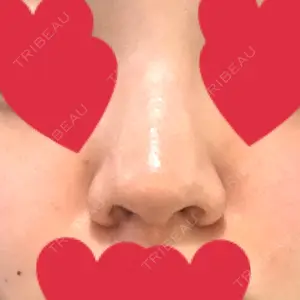 HANABI整形外科口コミ
