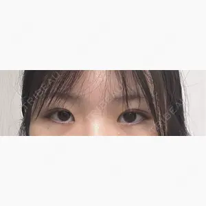 東京美容外科 仙台院口コミ