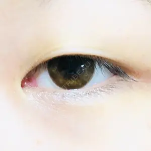 湘南美容クリニック 松山院口コミ