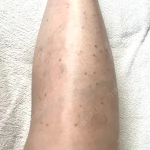 Mavie Beauty Clinic （マヴィービューティークリニック）口コミ