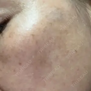 アスク美容クリニック銀座口コミ