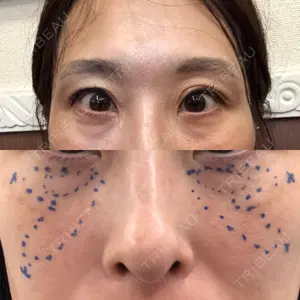 湘南美容クリニック 八王子院口コミ