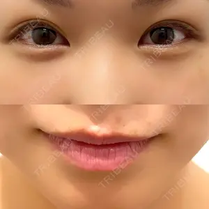 TCB東京中央美容外科 なんば院口コミ