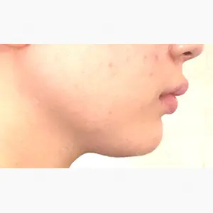 TCB東京中央美容外科 船橋院口コミ